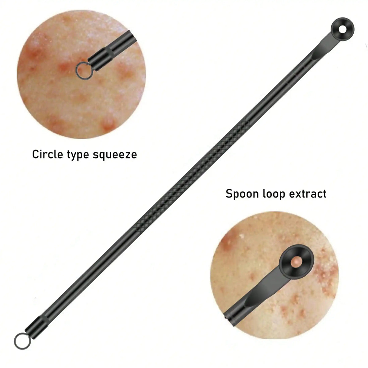 Professional Blackhead Extractor Set – 4 Piece