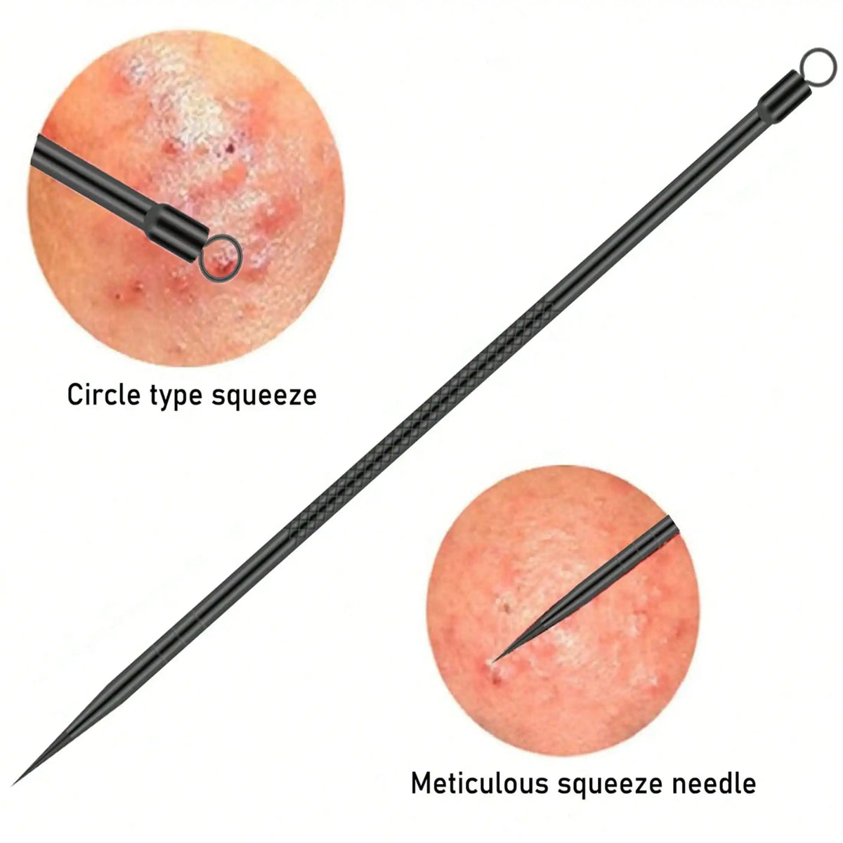 Professional Blackhead Extractor Set – 4 Piece
