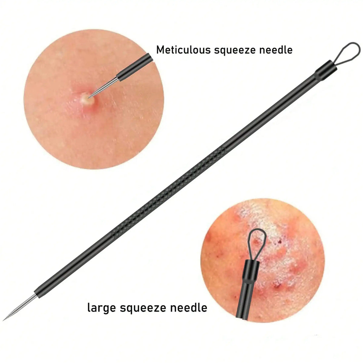 Professional Blackhead Extractor Set – 4 Piece
